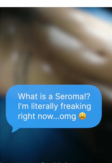 SEROMAS! What a seroma is and why it is one of the most common post op questionswe hear! 💬 A seroma happens when your body produces more fluid than it can absorb, causing it to collect between the skin and muscle. 💡 We also walk through what to do if one develops, including drainage options depending on whether your incisions are still open or fully closed. The key thing to know is that seromas are not emergencies 🚨 In many cases, smaller seromas resolve on their own with proper compression a