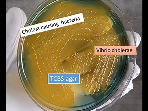 TCBS agar with Vibrio cholerae showing yellow colonies
