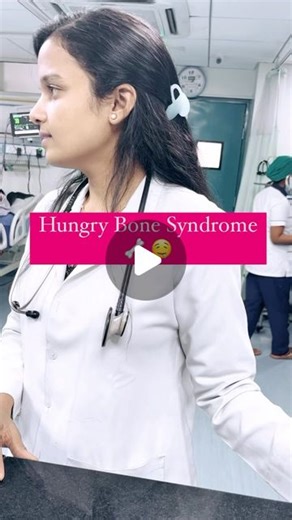 Dr. Nidhi Raka on Instagram: "Hungry Bone Syndrome 🦴🤤 . Hungry bone syndrome (HBS) is a condition that can occur after the surgical removal of the parathyroid glands (parathyroidectomy), particularly in patients with hyperparathyroidism. It involves a rapid, severe, and prolonged drop in blood calcium levels (hypocalcemia) due to the bones’ increased uptake of calcium. Here’s an overview: Causes • Parathyroidectomy: The most common cause is the removal of one or more overactive parathyroid gla