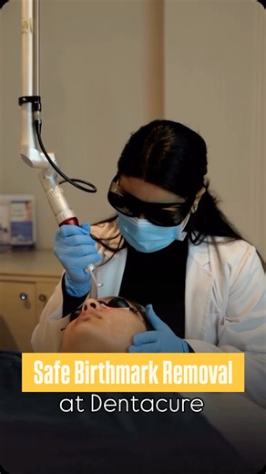 Denta Cure on Instagram: "Say goodbye to unwanted birthmarks with advanced Birthmark Removal at Dentacure ✨ We use the latest Tri-Beam Laser Device, designed to precisely target birthmarks while protecting surrounding skin. Our dermatologist-led, customized treatments ensure safe, effective results with minimal discomfort and downtime. Suitable for various skin types, the Tri-Beam laser helps achieve clearer, even-toned skin and renewed confidence. 📞 For consultation & appointments: 7014863254