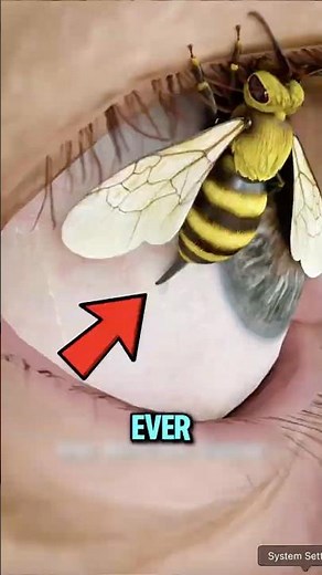 If a Bee Stings Your Eye — Do THIS or You Could Go Blind!