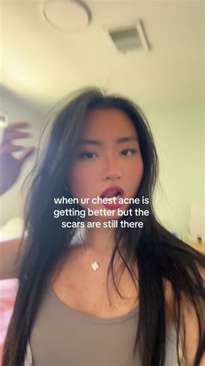 Clearing Chest Acne Scars: My Skincare Routine