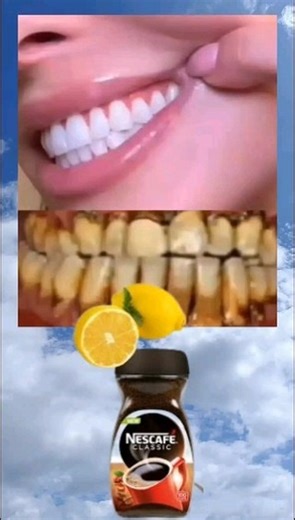 27K views · 7.7K reactions | The Perfect Tooth Brushing Routine: A...