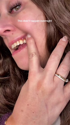 Essential Tips for Effective Oral Hygiene Practices