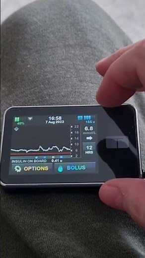 Control IQ - Hybrid Closed Loop Over 24 Hours | T:Slim X2 Insulin Pump