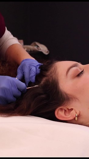 Preview of sharp or dull testing fail & sensory loss scalp check on a viewer! #asmr #asmrsharpordull #asmrsensory #asmrsensationtest #satisfying #oddlysatisfying #asmrsounds #asmrdoctor #asmrexam #asmrroleplay #asmrforsleep #chilibasmr #fyp