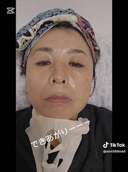 メソスキンカラー体験と美容効果