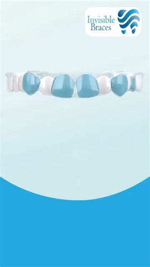 "Big discount for one week only on clear aligners Invisible braces The offer is valid until Thursday, 30/10/2025 Payment plan: 1. Single jaw: Pay 4500 deposit and 1000 monthly installments until the end of treatment. 2. Upper and lower jaw: Pay 6000 deposit and 1400 monthly installments until the end of treatment. Cash payment system: - Any case for both jaws: Pay 14000 EGP and follow-up every 2-3 months with 800 EGP until the end of treatment. - Any case for a single jaw: Pay 11500 EGP and foll