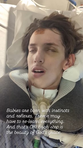 1.1M views · 1.8K reactions | 11/9/24 - Learning how to breathe on his own again. Big step, first time opening his eyes!!! Even a smidgen is HUGE! Immediately after having to really focus on his lungs, his eyes took a break. Now he's resting pretty heavily. It's a lot of work. | Rev4trev | Facebook