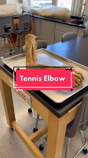 Lateral Epicondylitis is an inflammation and irritation of the lateral epicondyle. @weebe1976 #AnatomyClass #ScienceClass #TennisElbow #AnatomyIsCool