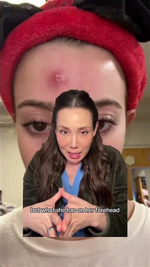 What to do about a large infected pimple like this...