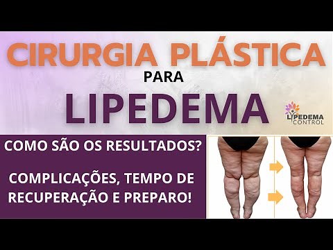 Cirurgia plástica para Lipedema: como são os resultados? Complicações, recuperação e preparo!