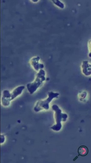 Brain-Eating Amoeba: Naegleria fowleri Under the Microscope