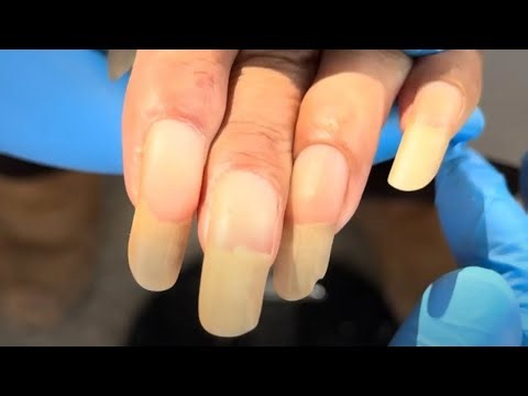 Beautiful Fingernails, Too Long, Perfectly Trimmed【Podiatry Clinic】
