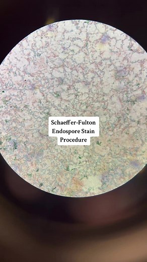 Schaeffer-Fulton Endospore Procedure in Microbiology Lab