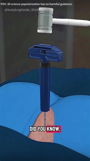 How Bone Marrow Transplant Surgery Is Performed ( 3D Animation)#3dmedicalanimation#medical3danimation#bonemarrowtransplant#bonemarrowsurgery#bonemarrowrecovery