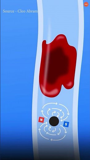 A Microscopic Robot That Delivers Drugs Exactly Where Needed