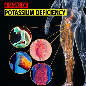 156K views · 3.7K reactions | 4 signs that your body gives you to indicate potassium deficiency in your body. | Doctor ASKY | Facebook