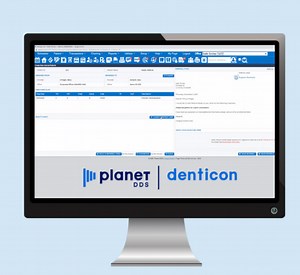 Denticon, the First Cloud-Enabled PMS in Dentistry