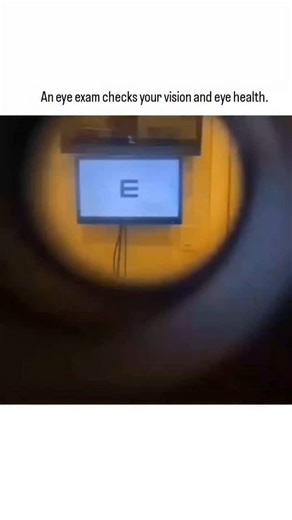 Science | An eye exam is more than just checking if you need glasses—it's a complete check-up of your vision and overall eye health. During the exam,... | Instagram