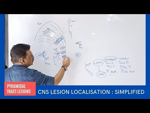 CNS Lesion Localisation at your Finger Tips by Dr Gireesh Kumar KP || Simplified Version