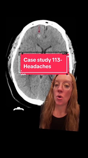 Case Study 113: Headaches Diagnosis Explained Tomorrow