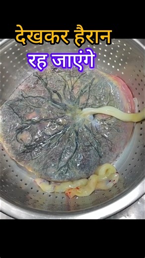 Placenta #shorts #youtubeshorts #nurse #nursing #healthtips #medical #pregnancy #care #hospital