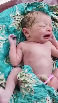 Beautiful newborn baby just after birth who wants to stay in womb position #Newborn #Baby #CuteBaby #Babies #CuteBabies #FunnyBaby #BabyLaught | Super Babies