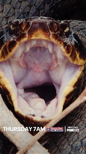 48K views · 156 reactions | LUCKY TO BE ALIVE: The venom of a vicious water moccasin's bite nearly claimed this Orlando man's right hand. Amy Kaufeldt FOX 35 shares his amazing story of survival, tomorrow on Good Day Orlando. | FOX 35 Orlando | Facebook