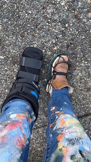 56 reactions · 15 comments | If you haven’t seen my stories, I broke...