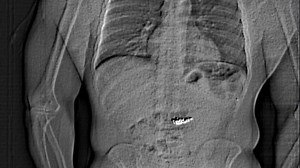 Suspected Thief Stole $800,000 in Tiffany Jewelry—Then Swallowed It