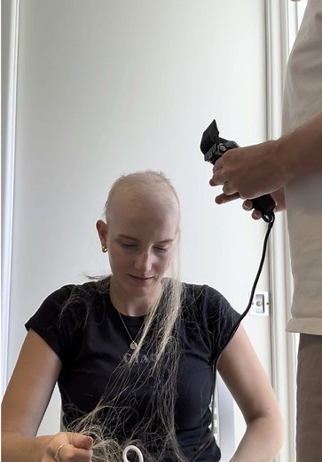 Navigating Alopecia: My Journey After Shaving My Head