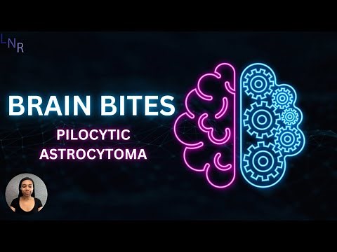 Brain Bites – Pilocytic astrocytoma