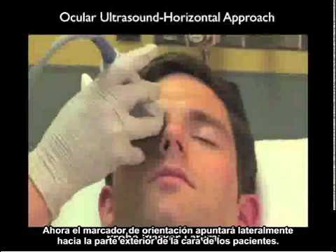 Procedimiento para realizar una ecografía ocular en un estudio de caso - Parte 1