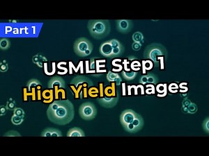 USMLE Step 1 High Yield Images (Part 1) [REFRESHED]