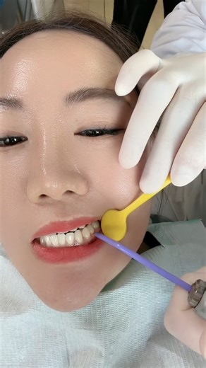 Gum Infection Symptoms & Treatment | How to Cure Gum Pain Naturally #guminfection #gumcare