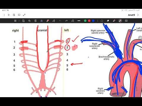 CVS_anatomy_L9 development of aortic arches