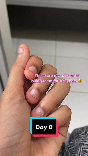 Growing Nails After Biting: Nail Growth Journey