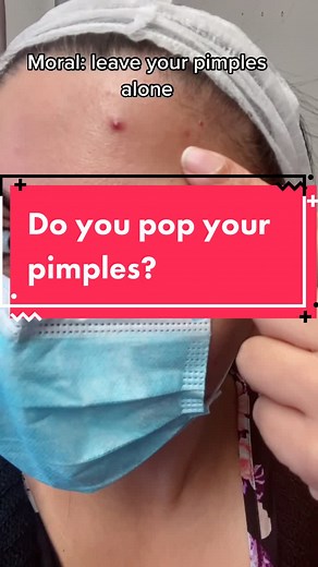 Should You Pop Pimples or Leave Them Alone?