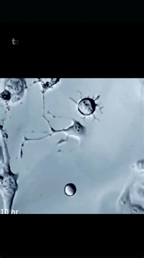 Neural Wiring: Brain Cells Finding Their Network #neuroscience #neurons #neuralnetworks #brain