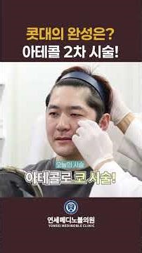 First session is the start, second is the details 🤟 Is this Artecoll nose bridge effect for real?...