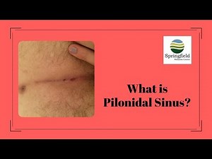 What is Pilonidal Sinus | Dr Maran