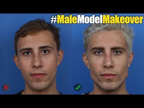 NYC Male Model Makeover with Facial Filler by Dr. Steinbrech #6