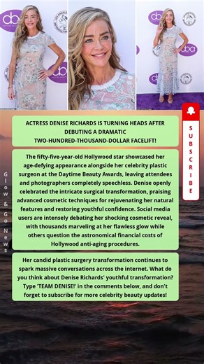Denise Richards' Shocking $200K Facelift! 😳✨ #shorts #trending