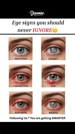 Eye conditions you should never IGNORE 😳
