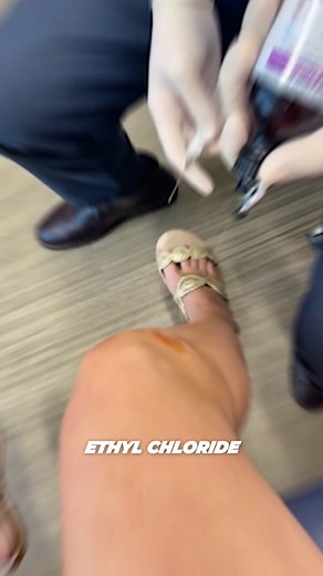 Afraid of needles? 🙈 Ethyl chloride spray (cold or vapocoolant topical spray) can be used to help decrease the pain associated with joint injections. In studies, patients pretreated topically with ethyl chloride experienced significantly less pain compared to the control group. Some studies suggest even LESS pain when patients were sprayed (ethyl chloride applied topically) twice. #injections . 👇 Have you had a hip or knee injection? Did the Ethyl Chloride spray make it easier? . joint injecti