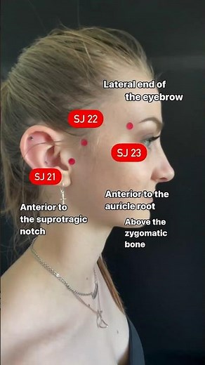 Acupuncture Points for Tinnitus #acupuncture