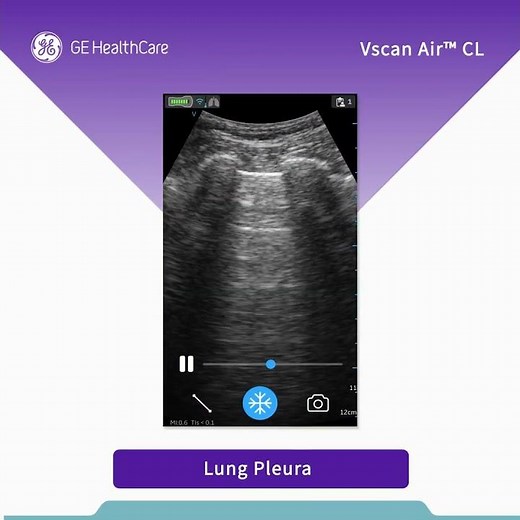 Vscan AIR™ CL- Your Visual Stethoscope.