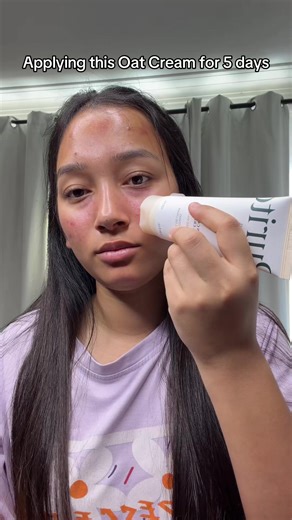 Fungal Acne Safe Moisturiser #Purito #Oatcream #Koreanskincare #PuritoSeoulPrivileges @PURITO SEOUL