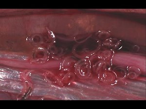 Anisakis: causas, síntomas y recomendaciones